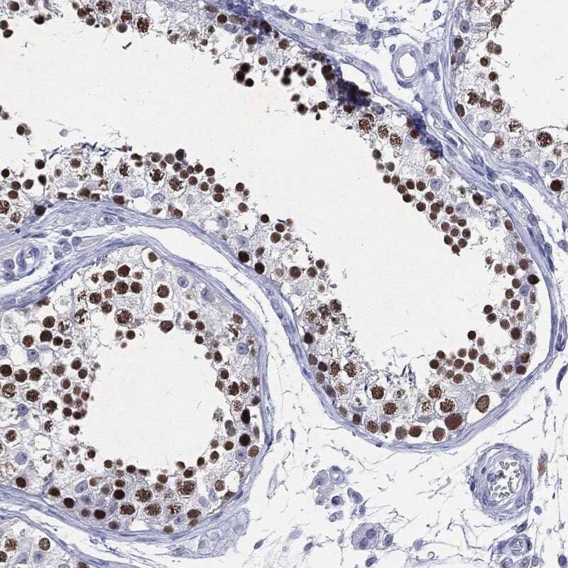 SSX1 Antibody Immunohistochemistry-Paraffin: SSX1 Antibody [NBP3-25157]