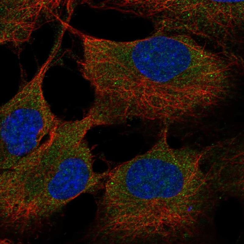 ST6 Sialyltransferase 6/ST6GALNAC6 Antibody Immunocytochemistry/Immunofluorescence: ST6 Sialyltransferase 6/ST6GALNAC6 Antibody [NBP3-25158]