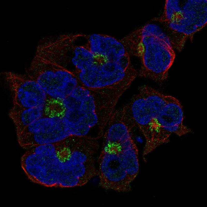 ST8 alpha-2,8-Sialyltransferase 4/ST8SIA4 Antibody Immunocytochemistry/Immunofluorescence: ST8 alpha-2,8-Sialyltransferase 4/ST8SIA4 Antibody [NBP3-25159]