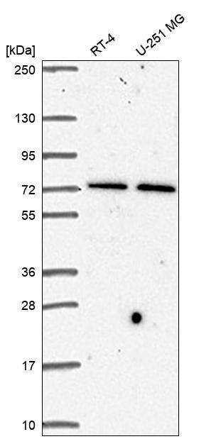 STAM-1 Antibody Western Blot: STAM-1 Antibody [NBP3-25160]