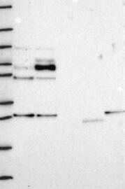 STAU2 Antibody Western Blot: STAU2 Antibody [NBP3-25161]