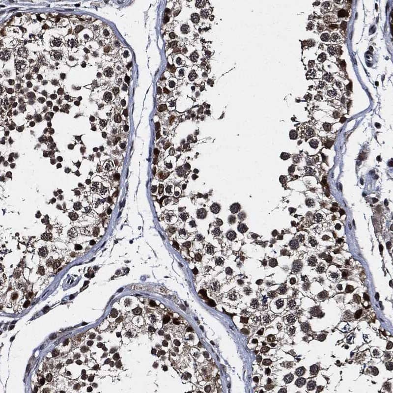 SUGT1 Antibody Immunohistochemistry-Paraffin: SUGT1 Antibody [NBP3-25165]