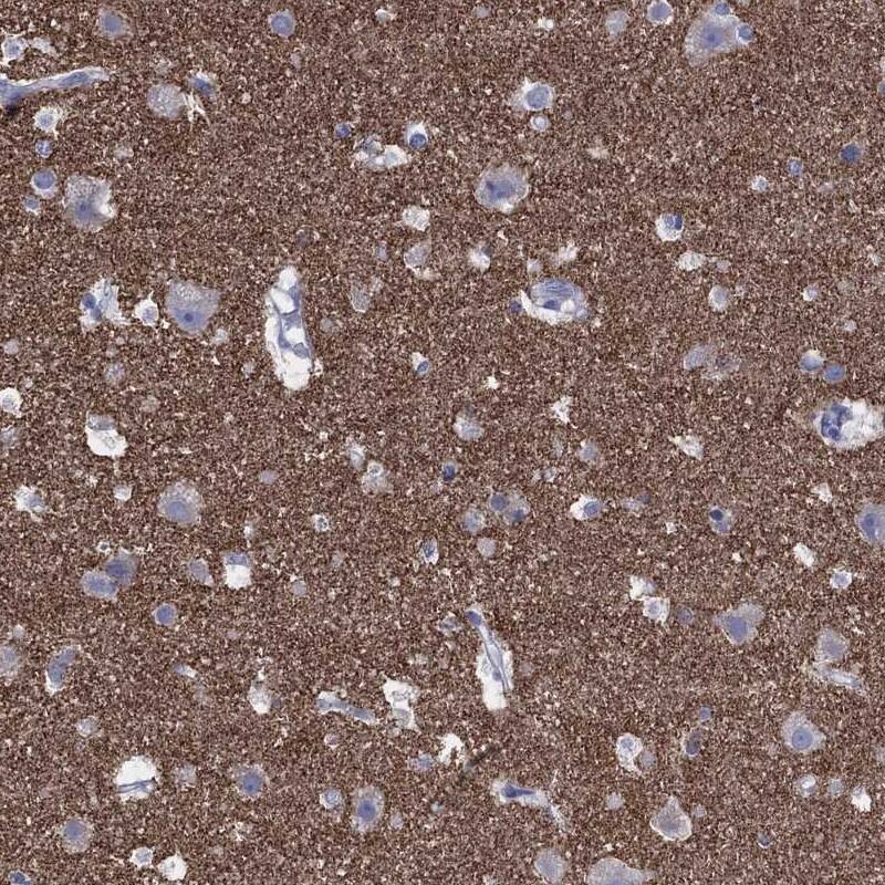 Synaptophysin Antibody Immunohistochemistry-Paraffin: Synaptophysin Antibody [NBP3-25167]