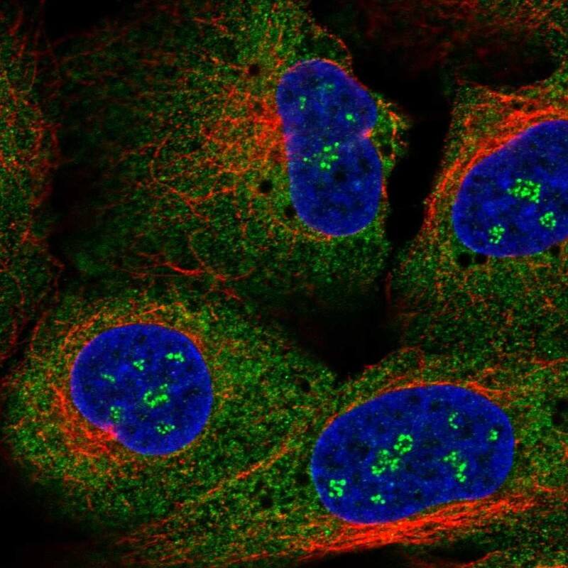 Synaptotagmin 8 Antibody Immunocytochemistry/Immunofluorescence: Synaptotagmin 8 Antibody [NBP3-25168]