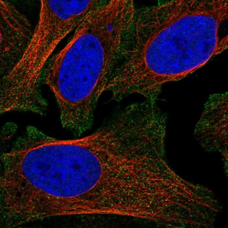 Syndecan-2/CD362 Antibody Immunocytochemistry/Immunofluorescence: Syndecan-2/CD362 Antibody [NBP3-25169]