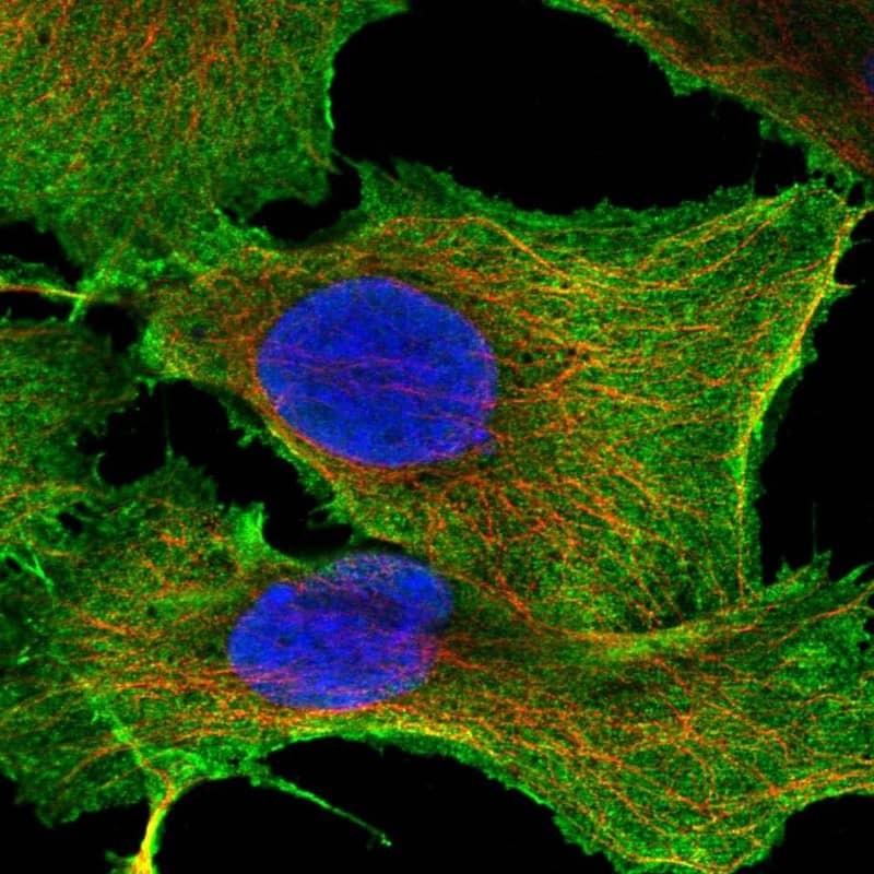 Syndecan-2/CD362 Antibody Immunocytochemistry/Immunofluorescence: Syndecan-2/CD362 Antibody [NBP3-25170]