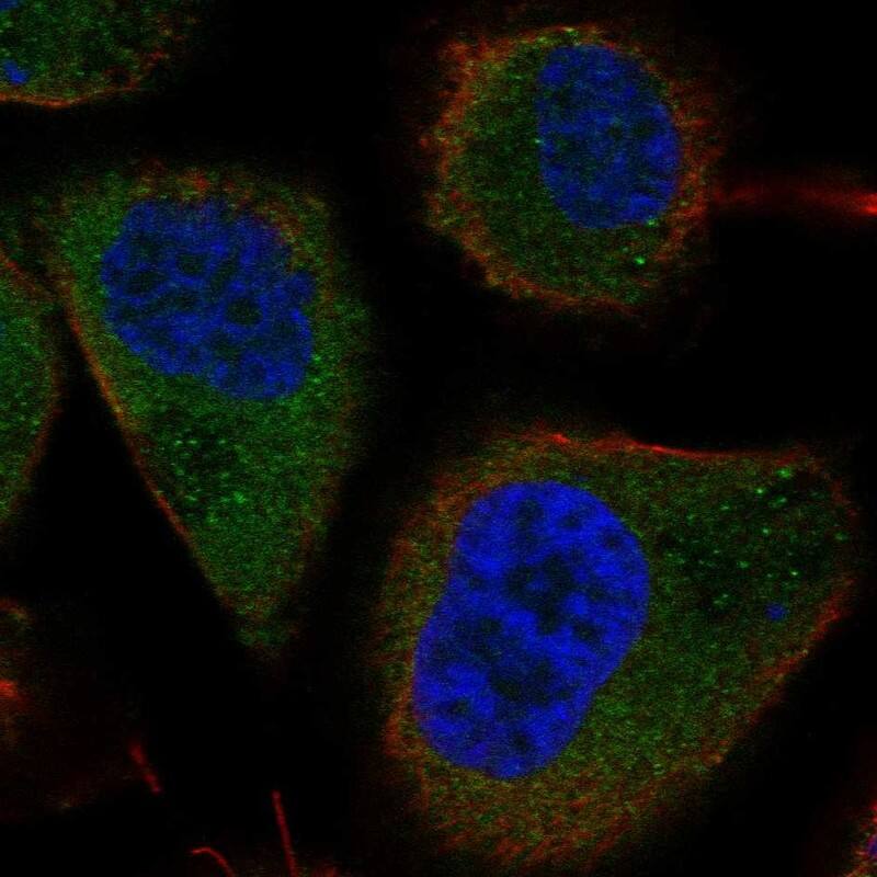 TBC1D13 Antibody Immunocytochemistry/Immunofluorescence: TBC1D13 Antibody [NBP3-25172]