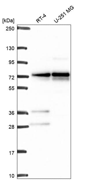 TBC1D22A Antibody Western Blot: TBC1D22A Antibody [NBP3-25173]