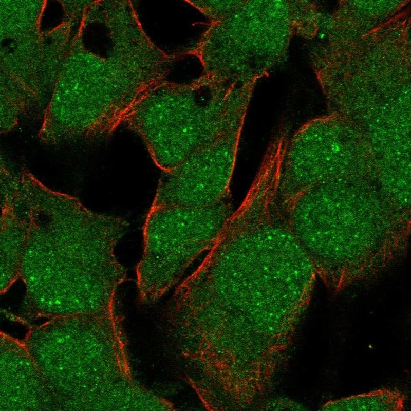 TBX10 Antibody Immunocytochemistry/Immunofluorescence: TBX10 Antibody [NBP3-25174]