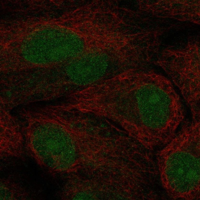 TCF21 Antibody Immunocytochemistry/Immunofluorescence: TCF21 Antibody [NBP3-25175]