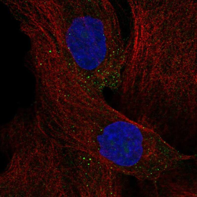 TCTEX1D4 Antibody Immunocytochemistry/Immunofluorescence: TCTEX1D4 Antibody [NBP3-25176]