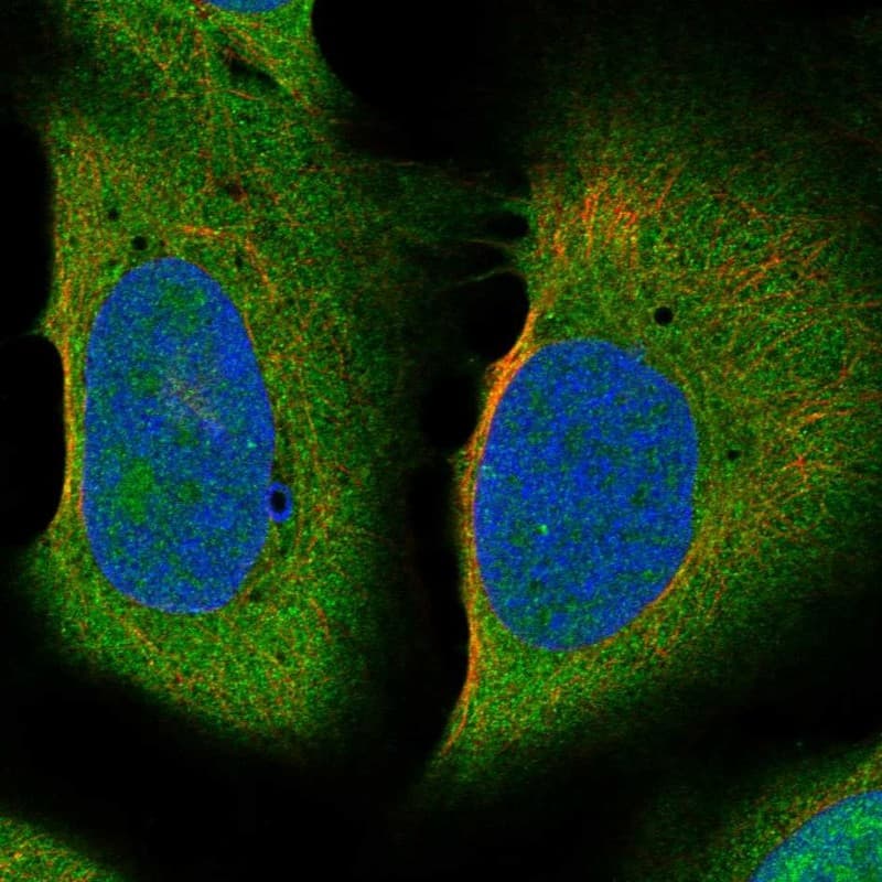 TEKT3 Antibody Immunocytochemistry/Immunofluorescence: TEKT3 Antibody [NBP3-25177]