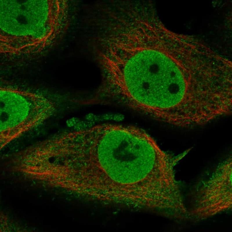 Teneurin-1 Antibody Immunocytochemistry/Immunofluorescence: Teneurin-1 Antibody [NBP3-25178]