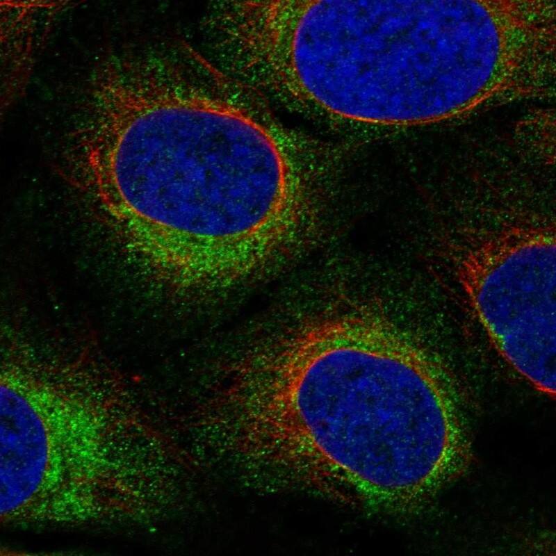 Testis expressed 264 Antibody Immunocytochemistry/Immunofluorescence: Testis expressed 264 Antibody [NBP3-25180]