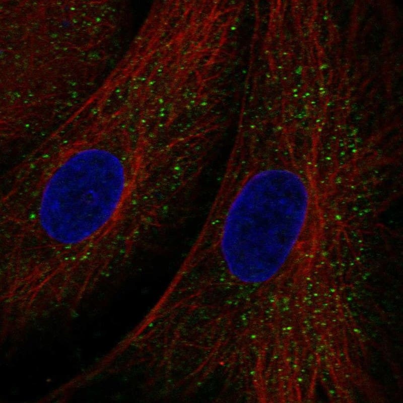 Testis expressed 36 Antibody Immunocytochemistry/Immunofluorescence: Testis expressed 36 Antibody [NBP3-25181]