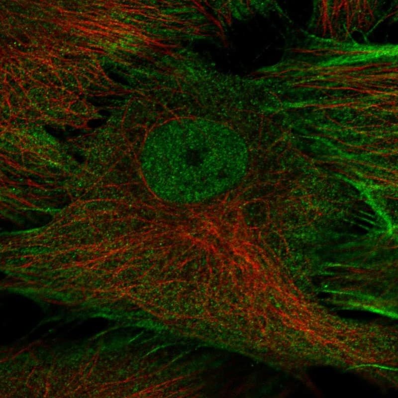 Tetraspanin-5 Antibody Immunocytochemistry/Immunofluorescence: Tetraspanin-5 Antibody [NBP3-25182]