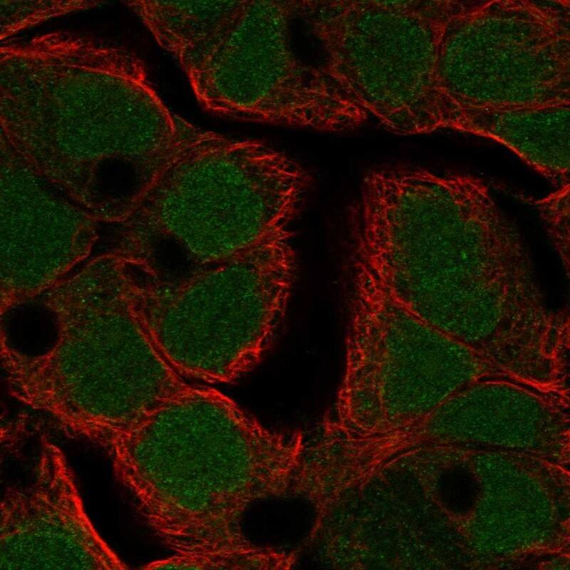 TFDP3 Antibody Immunocytochemistry/Immunofluorescence: TFDP3 Antibody [NBP3-25186]