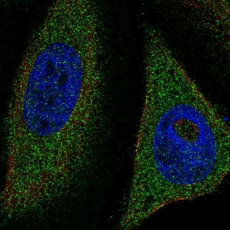 TFEB Antibody Immunocytochemistry/Immunofluorescence: TFEB Antibody [NBP3-25187]