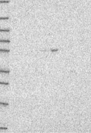 TFEB Antibody Western Blot: TFEB Antibody [NBP3-25187]