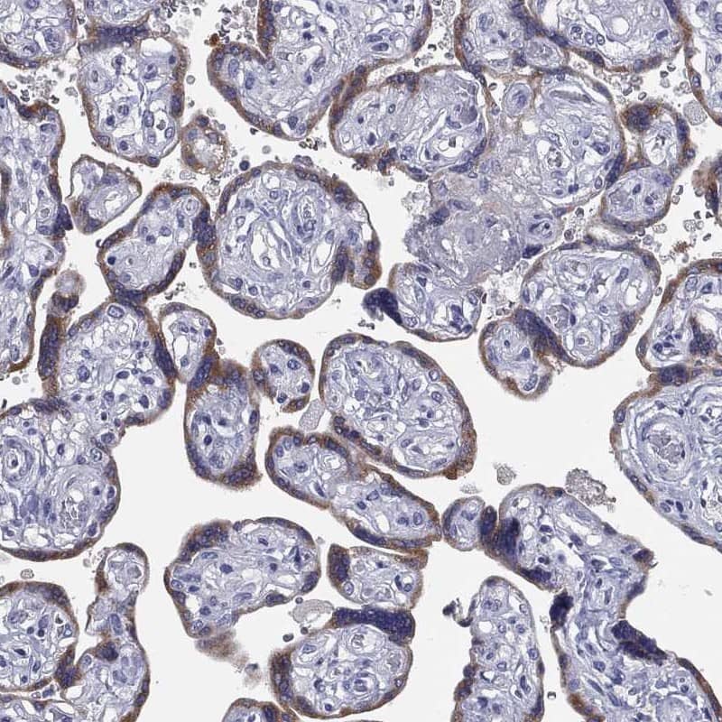 TFPI-2 Antibody Immunohistochemistry-Paraffin: TFPI-2 Antibody [NBP3-25188]