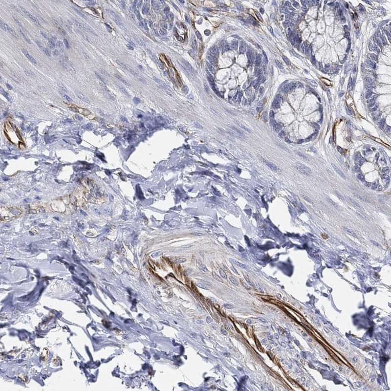 THSD1 Antibody Immunohistochemistry-Paraffin: THSD1 Antibody [NBP3-25189]