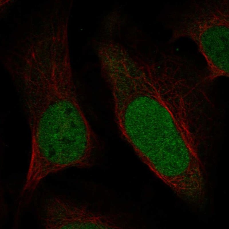 TIAL1 Antibody Immunocytochemistry/Immunofluorescence: TIAL1 Antibody [NBP3-25191]