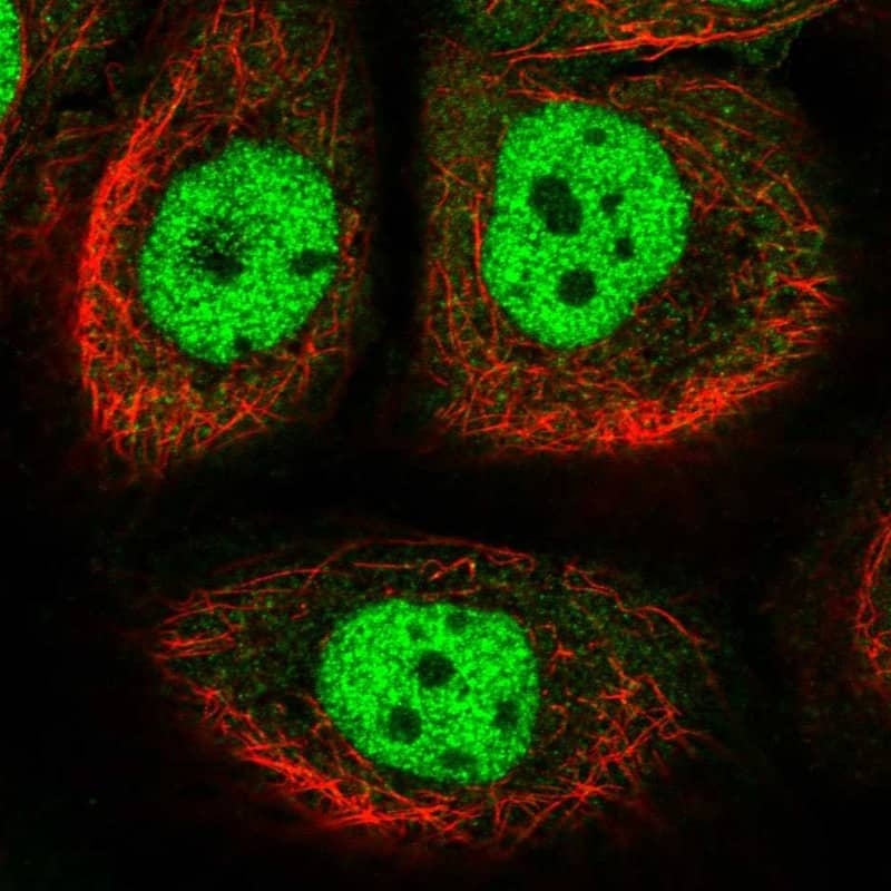 TIAL1 Antibody Immunocytochemistry/Immunofluorescence: TIAL1 Antibody [NBP3-25192]