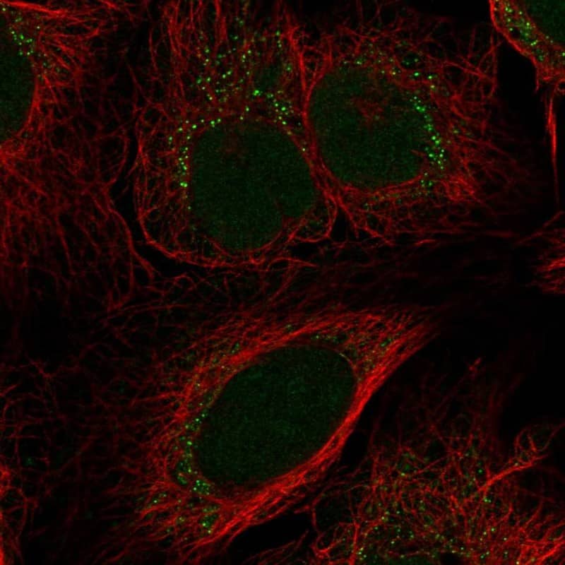 TIGD6 Antibody Immunocytochemistry/Immunofluorescence: TIGD6 Antibody [NBP3-25193]