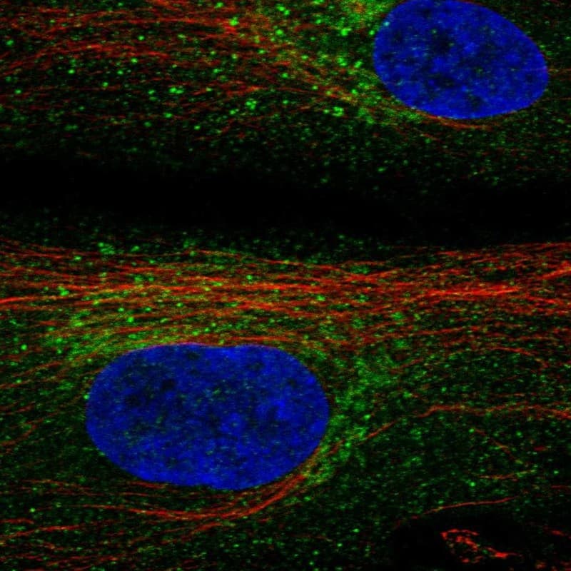 TIMP-3 Antibody Immunocytochemistry/Immunofluorescence: TIMP-3 Antibody [NBP3-25194]