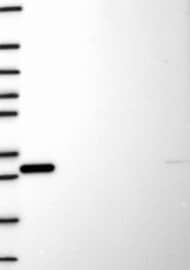 TIP60 Antibody Western Blot: TIP60 Antibody [NBP3-25195]