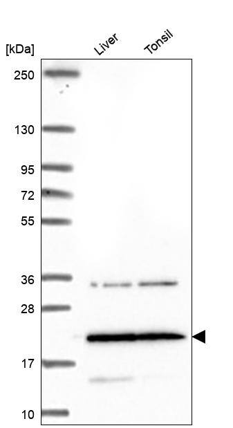 TM4SF18 Antibody Western Blot: TM4SF18 Antibody [NBP3-25196]