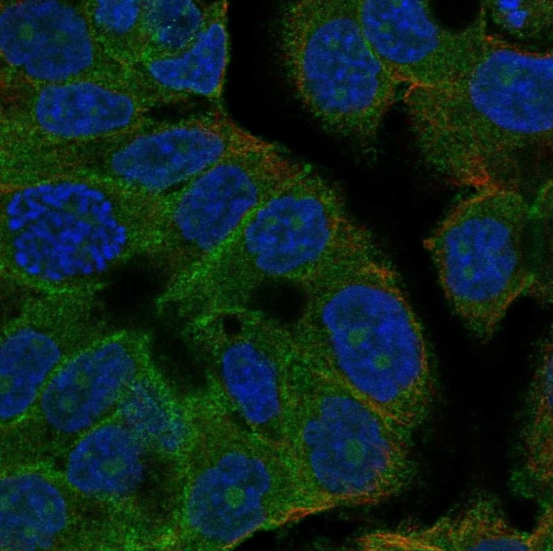 TMEM2 Antibody Immunocytochemistry/Immunofluorescence: TMEM2 Antibody [NBP3-25198]