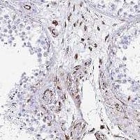 TMEM54 Antibody Immunohistochemistry-Paraffin: TMEM54 Antibody [NBP3-25201]