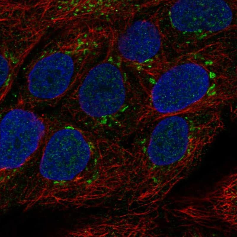 TMPRSS11E Antibody Immunocytochemistry/Immunofluorescence: TMPRSS11E Antibody [NBP3-25202]