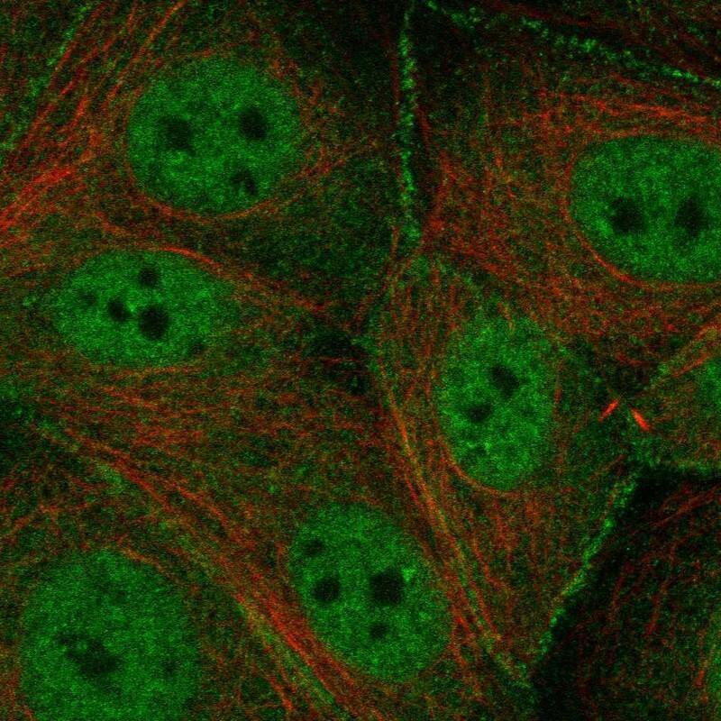 TMPRSS13 Antibody Immunocytochemistry/Immunofluorescence: TMPRSS13 Antibody [NBP3-25203]