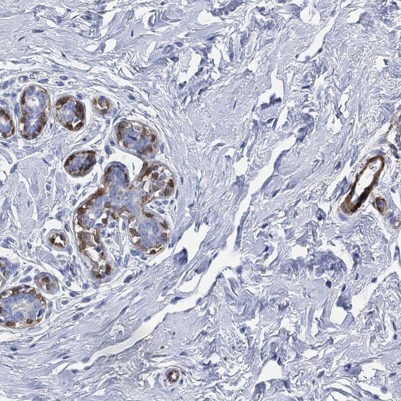 Transgelin/TAGLN/SM22 alpha Antibody Immunohistochemistry-Paraffin: Transgelin/TAGLN/SM22 alpha Antibody [NBP3-25205]