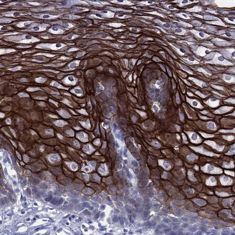 Transglutaminase 1/TGM1 Antibody Immunohistochemistry-Paraffin: Transglutaminase 1/TGM1 Antibody [NBP3-25206]