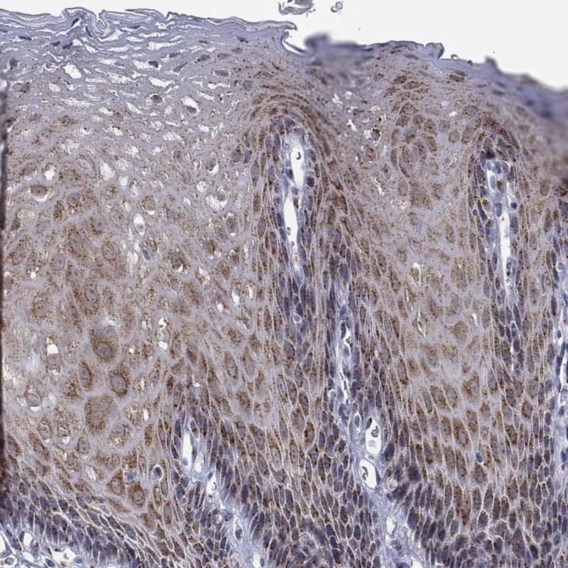 TRIF/TICAM1 Antibody Immunohistochemistry-Paraffin: TRIF/TICAM1 Antibody [NBP3-25207]