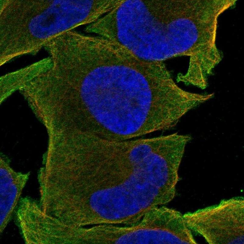 TSLPR/CRLF2 Antibody Immunocytochemistry/Immunofluorescence: TSLPR/CRLF2 Antibody [NBP3-25208]