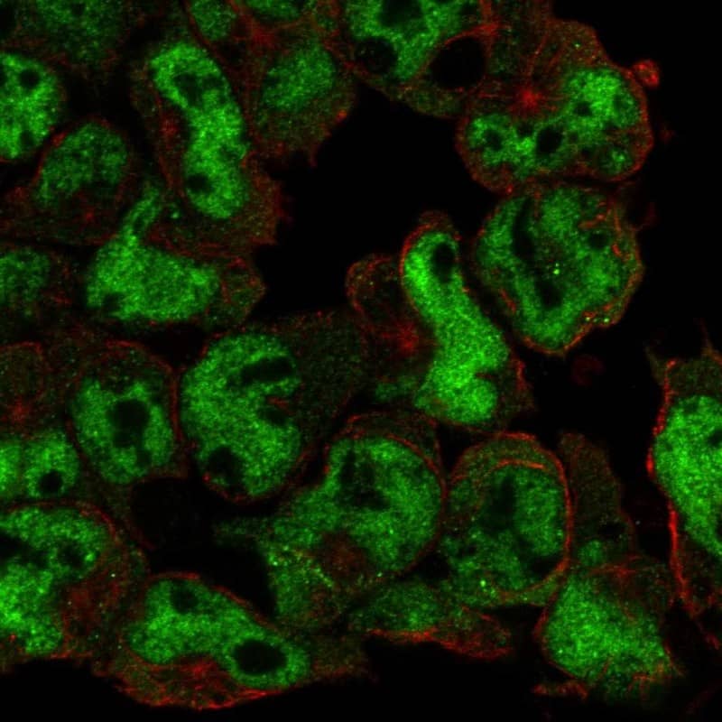 TULA/STS-2 Antibody Immunocytochemistry/Immunofluorescence: TULA/STS-2 Antibody [NBP3-25210]