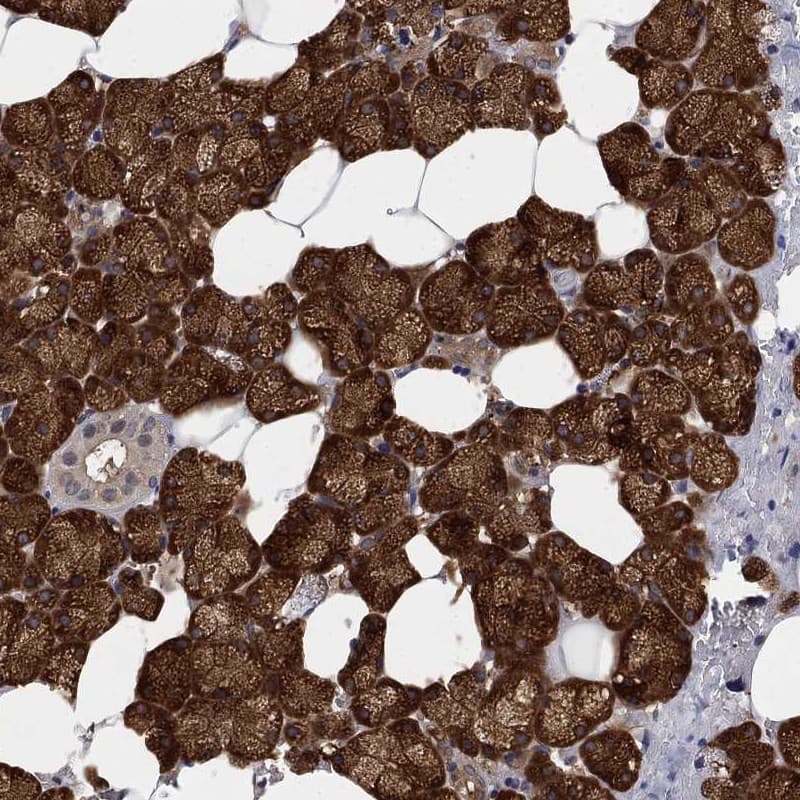 UFM1 Activating Enzyme/UBA5 Antibody Immunohistochemistry-Paraffin: UFM1 Activating Enzyme/UBA5 Antibody [NBP3-25215]