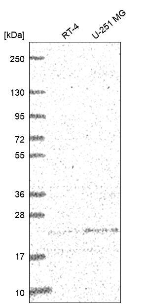 ULBP-2 Antibody Western Blot: ULBP-2 Antibody [NBP3-25217]