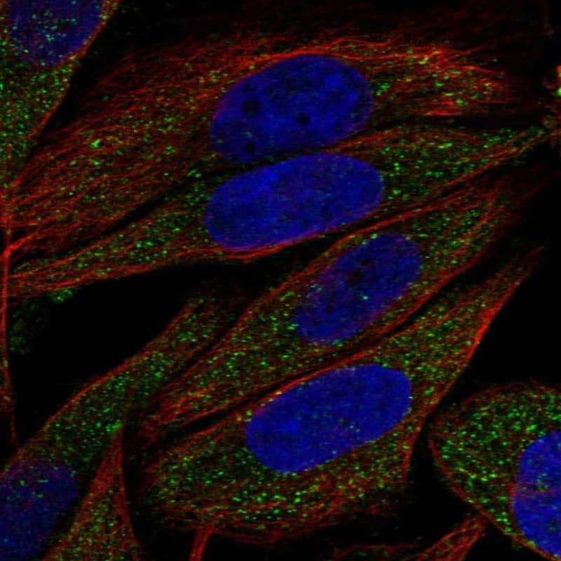 ULBP-2 Antibody Immunocytochemistry/Immunofluorescence: ULBP-2 Antibody [NBP3-25217]