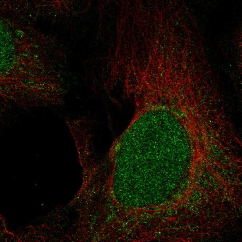 UNG Antibody Immunocytochemistry/Immunofluorescence: UNG Antibody [NBP3-25218]