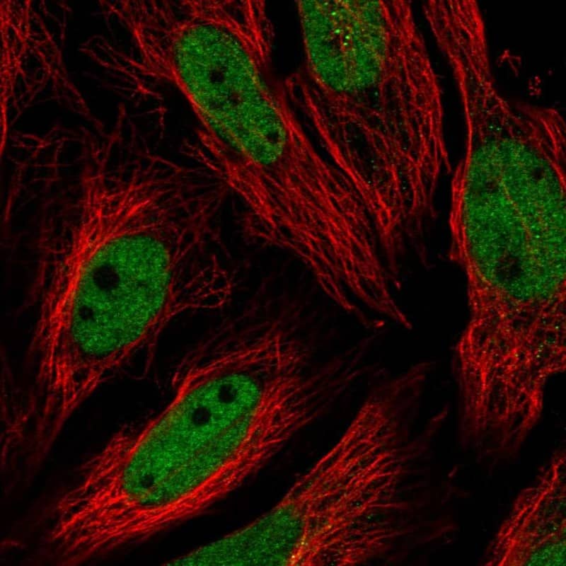 USF1 Antibody Immunocytochemistry/Immunofluorescence: USF1 Antibody [NBP3-25219]