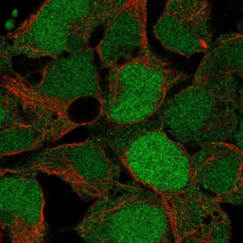 USP26 Antibody Immunocytochemistry/Immunofluorescence: USP26 Antibody [NBP3-25220]