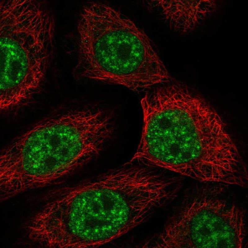 USP43 Antibody Immunocytochemistry/Immunofluorescence: USP43 Antibody [NBP3-25221]