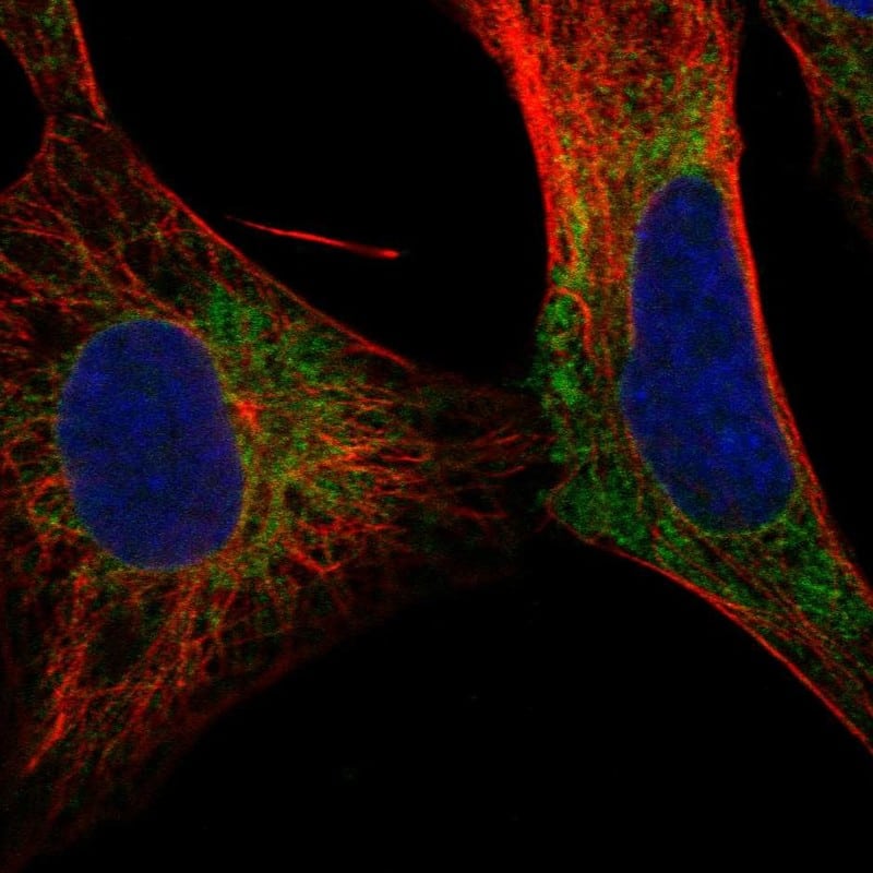 VGluT3 Antibody Immunocytochemistry/Immunofluorescence: VGluT3 Antibody [NBP3-25224]