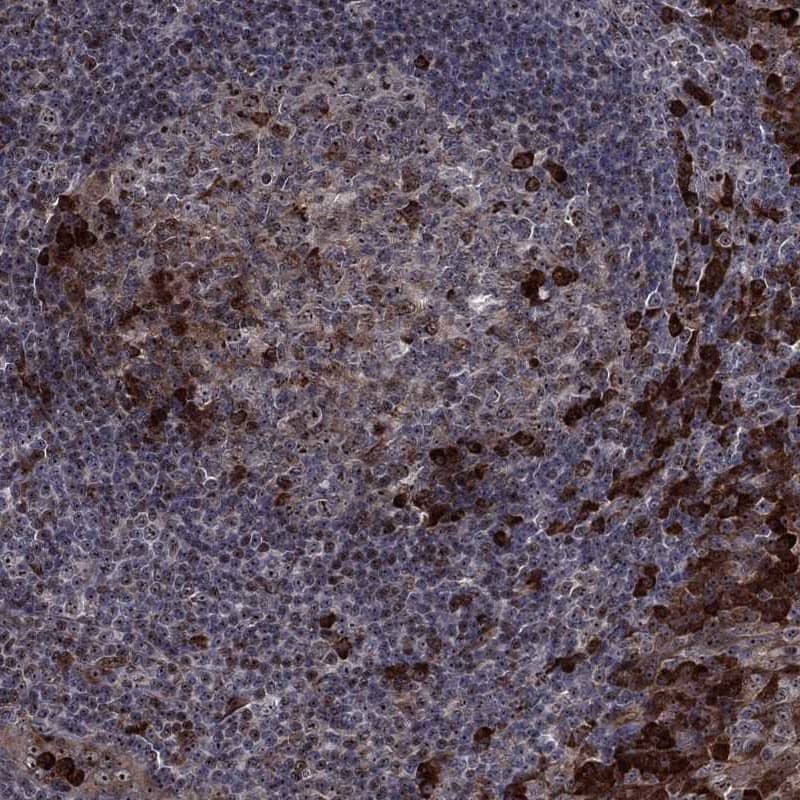 Von Hippel Lindau Antibody Immunohistochemistry-Paraffin: Von Hippel Lindau Antibody [NBP3-25225]