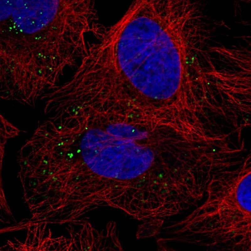 VPS25 Antibody Immunocytochemistry/Immunofluorescence: VPS25 Antibody [NBP3-25226]